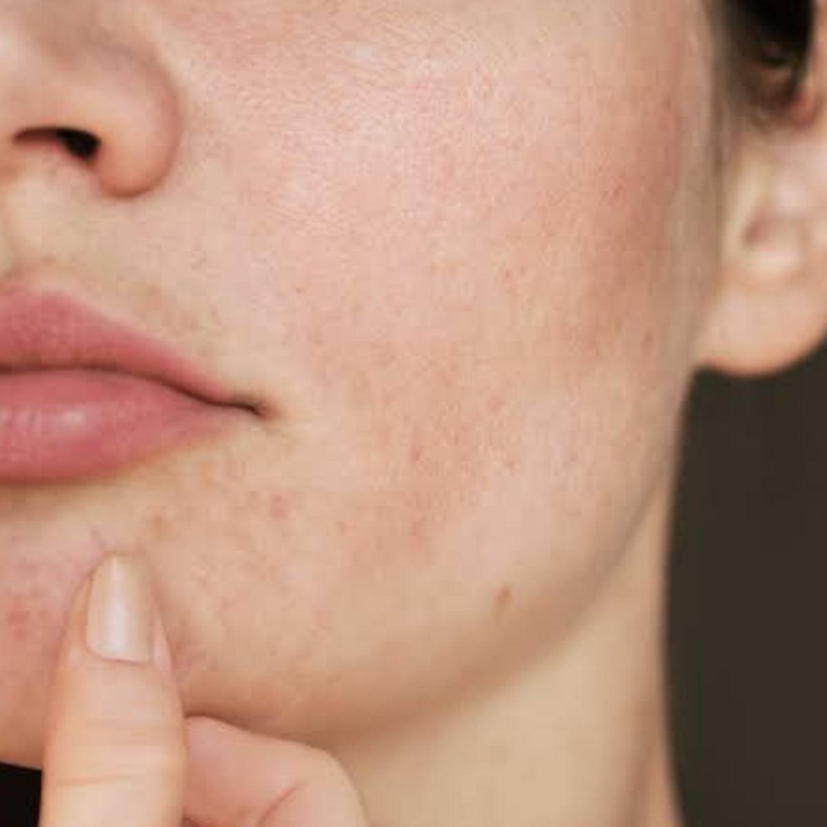 Dullness & Skin Brightening