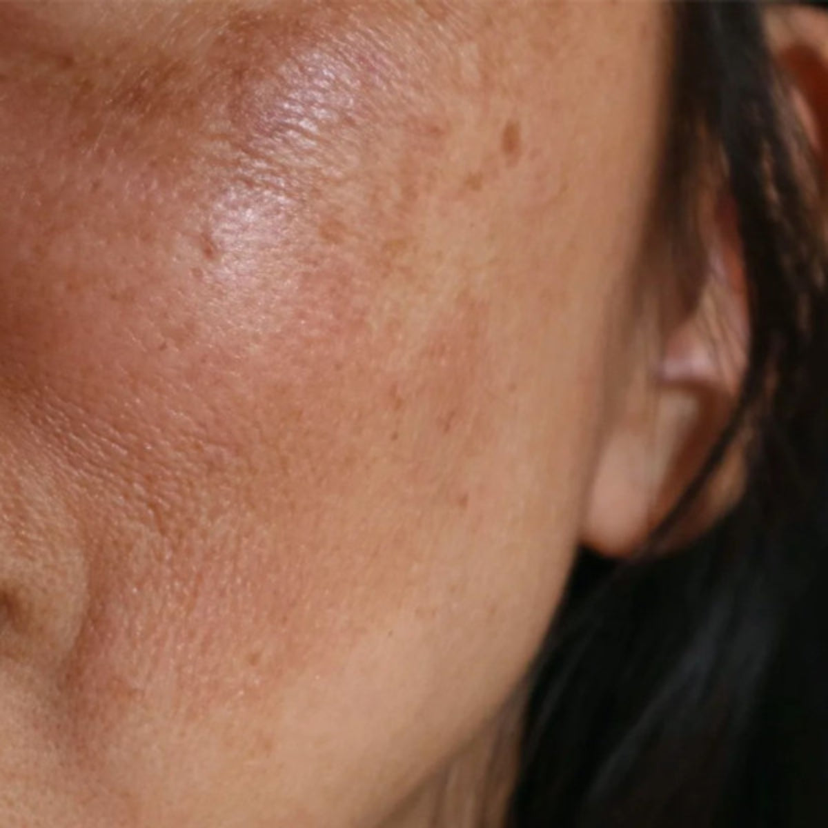 Dark Spots