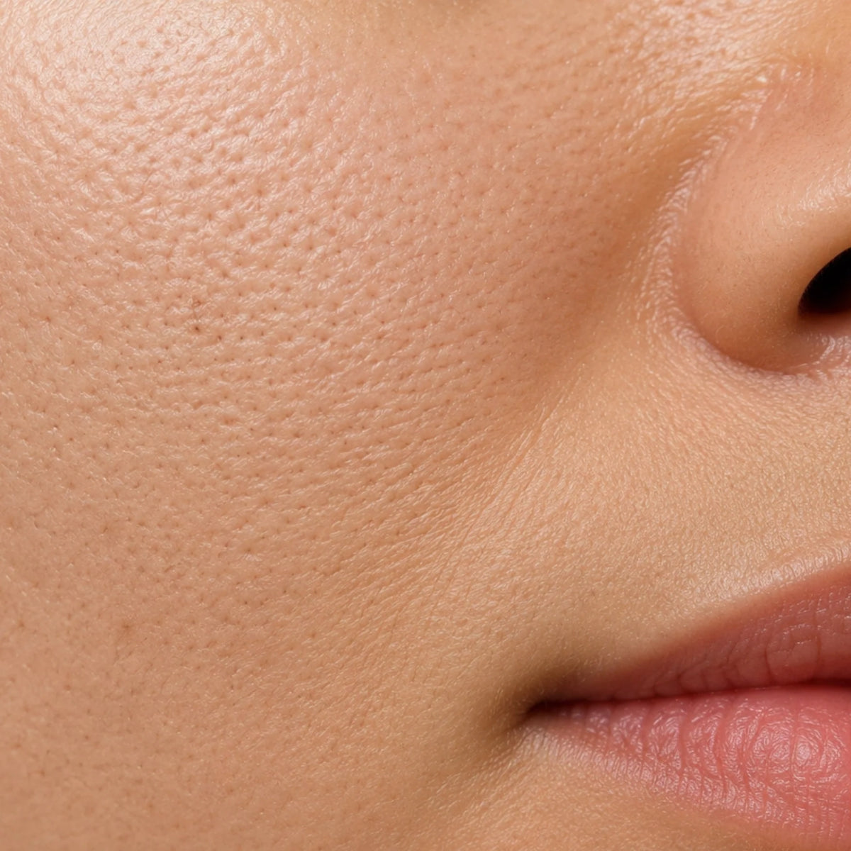 Open Pores
