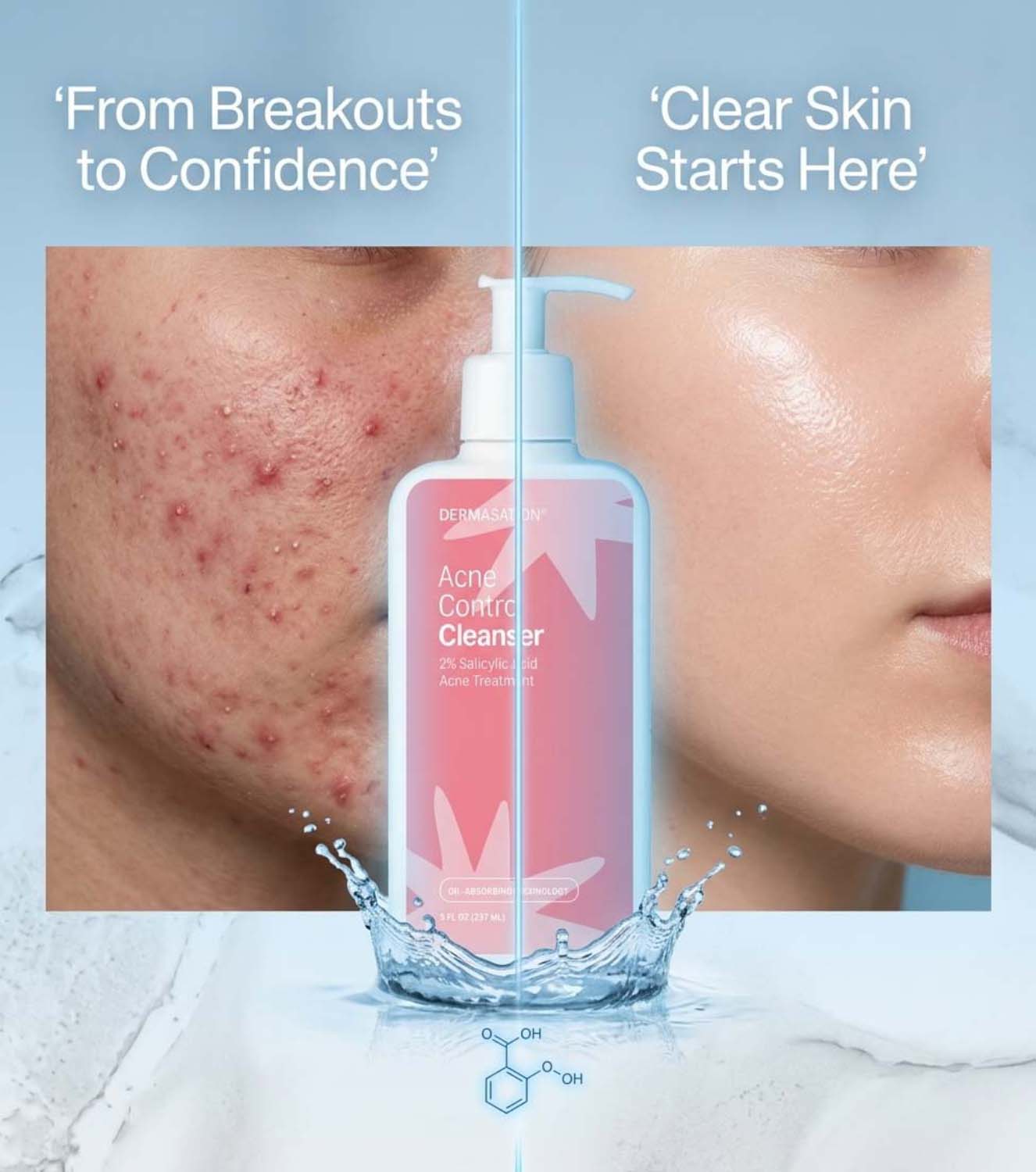 Acne Control Cleanser 237ML