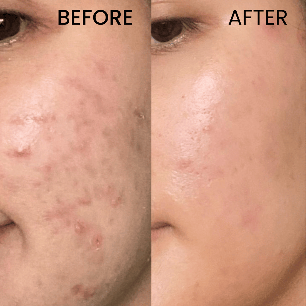 Glycolic Acid 7% Toning Solution 266ML