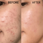 Glycolic Acid 7% Toning Solution 266ML