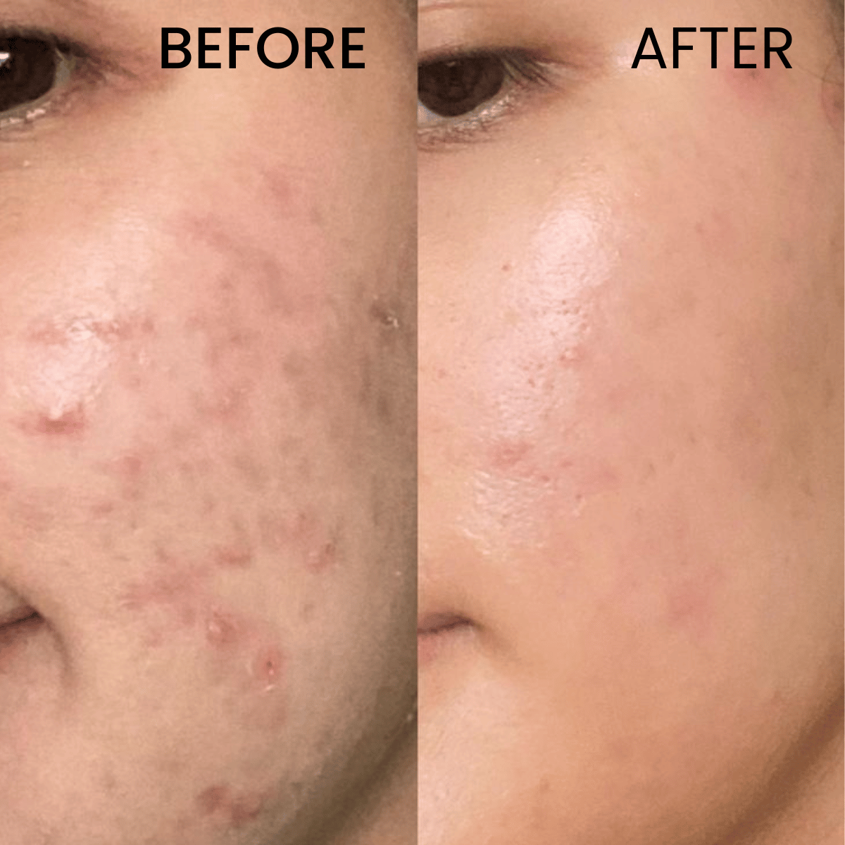 Glycolic Acid 7% Toning Solution 266ML