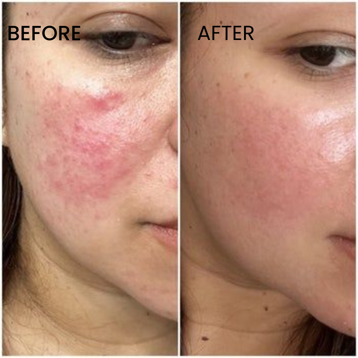 Glycolic Acid 7% Toning Solution 266ML